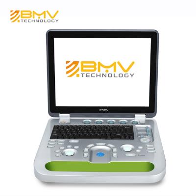 China Hospital Digital 3D/4D Ultrasound Ob Laptop Ultrasound Machine Best Price Sun-800d Full Color Doppler Ultrasound for sale