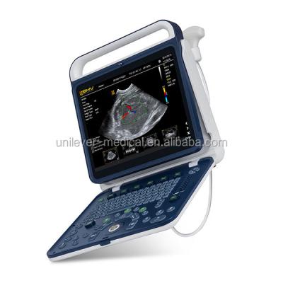 China BPU60 Ultrasound Scanner Color Doppler Laptop Ultrasound Scanner Portable Medical Device Laptop Ultrasound Ultrasound BPU60 for sale