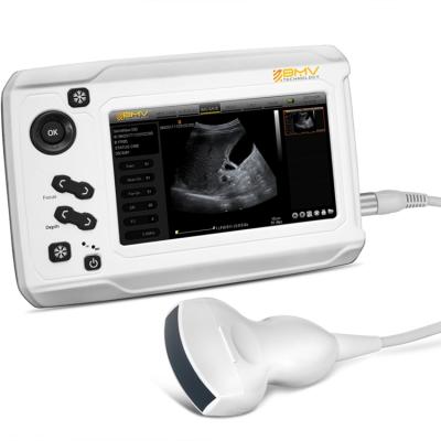 China Touch Screen Ultrasound Medical Ultrasound Scanner Handheld Portable Ultrasound MX300 for sale