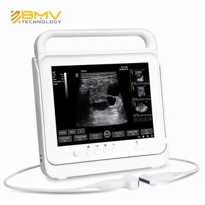 China DRAMINSKI Modern Abdomen Ultrasound Scanner with Excellent Ultrasound and High Quality Doppler Imaging Mindray TE5 for sale