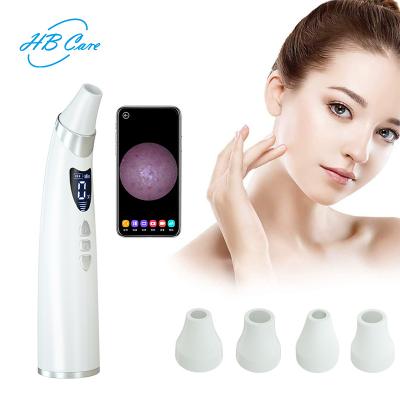 China High Quality Professional Video Acne Treatment Suction Blackhead Removal Electric Vacuum With Built-in 20x HD Amplification Camera for sale