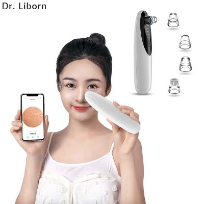 China New Electric Pore Treatment 2021 Blackhead Acne Remover Suction Extractor Tool Kit Acne Removal Blackhead Remover Prime Vacuum With Wifi Camera for sale