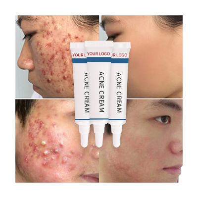 China Moisturizer Factory Customize OEM ODM Private Label Acne Scar Removal Acne Cream Natural Organic Herbal Treatment for sale