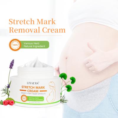 China Wholesale Natural Organic Stretch Nourishing Skin Care Scar Repair Stretchmark Abdomen Body Stretch Mark Removal Cream for sale