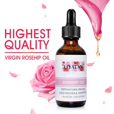 China Natural Organic Herb Plant Pure Rosehip Essential Oil Best Hair Growth Moisturizer Skin Care Multi Purpose for sale