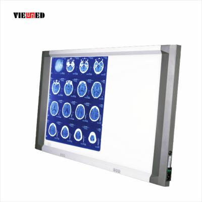 China Independent Dimming Freestanding X-Ray Led X-Ray Film Viewer Negatoscope Film Viewer for sale