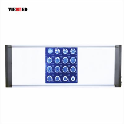 China Super Thin Medical Supplies Led Screen X Ray Film Sight Box Three for sale