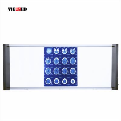 China Hot Selling Independent Dimming Independent Dimming Screen Three Led X-Ray Film Viewer for sale