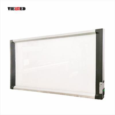 China Independent Dimming Double Independent Dimming Screen Led X-Ray Film Viewer for sale