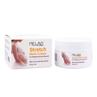 China Exfoliator Stretch Marks Cocoa Butter Cream Brand Creams For Extras And Scar Removal Better Private Label Cosmetics High Quality for sale