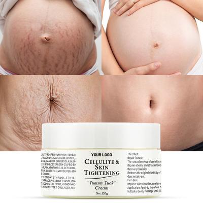 China Custom Wholesale Organic Skin Revitalizer Mango Aloe Vera Stretch Marks Removal Cream Private Label Stretch Marks Removal Cream For Body for sale