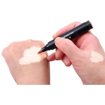 China Waterproof Not Waterproof Vitiligo White Spot Treatment Machine Skin Spot Vitiligo Color Makeup Concealer Cover Skin Cream Waterproof Vitiligo for sale