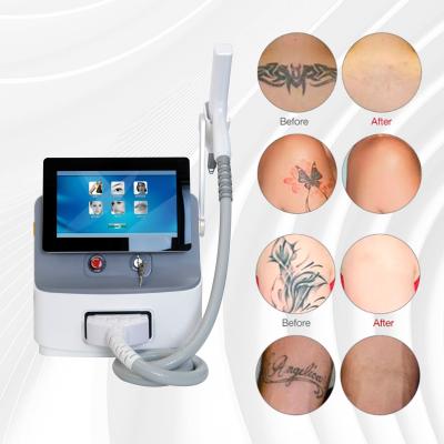 China Draagbare Picosecond Laser Machine 1064nm 532nm Pico Laser Tattoo Removal Machine Te koop