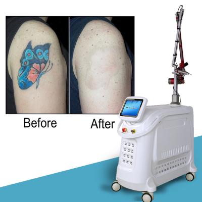 China 4 Wavelengths Nd YAG Q Switch Laser Machine Tattoo Removal Stationary Style for sale