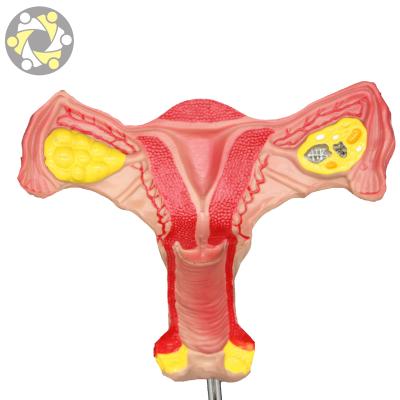 China High Quality Female Internal Uterus Anatomical Model of Medical Education and Laboratory Biology Genital Organs for sale