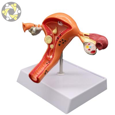 China Soft Female Internal Uterus Genital Organs Female Internal Uterus Medical And Biology PVC Model Anatomical Teaching for sale