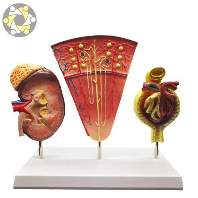 China Kidney Nephron and Glomerulus Education Pathology Medical Teaching Model for sale