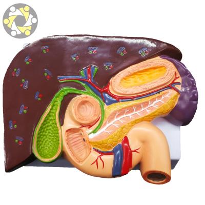 China Education Science Liver Pathology Medical Teaching Model With Duodenum Stomach for sale