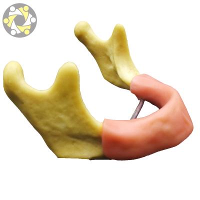 China Education Drilling Practice Implant Jaw Teeth Model Old Dental Base With Restoration for sale