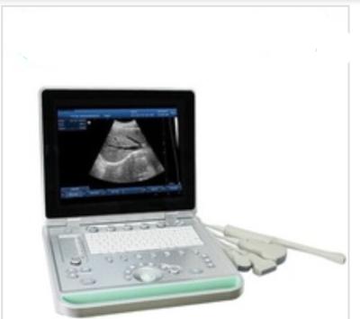 China Pregnancy Baby Acrylic Laptop Home Portable China Ultrasound Machine Scanner Price for sale