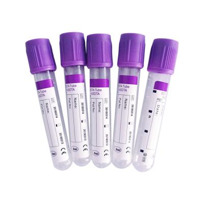 China Eco-friendly 10ml or Custom Mini Vacuum Blood Sampling Collection Tube for sale