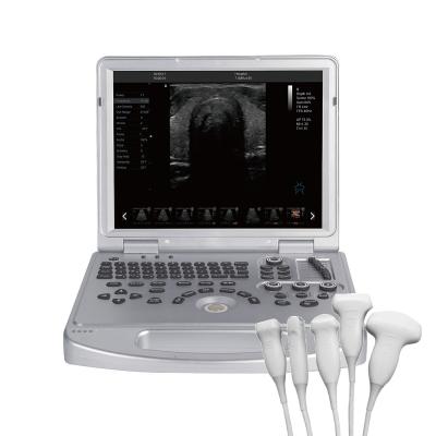 China Dawei Hot Selling Portable Pet Animal Health Diagnosis 3D 4D PW Ultrasound Color Doppler Ultrasound Price for sale