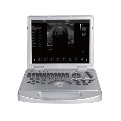 China Dawei Best Portable Veterinary Ultrasound Scanner System for Animal Health Diagnosis with Convex Probe for sale