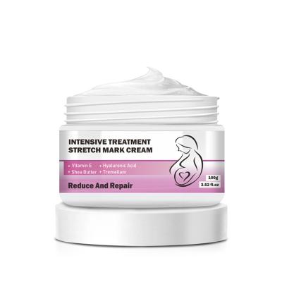 China Nourishing High Quality Stretch Marks Cream Effective Removal Pregnancy for sale