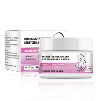 China Best Natural Nourishing Stretch Mark Cream Private Label For Cheap Prices for sale