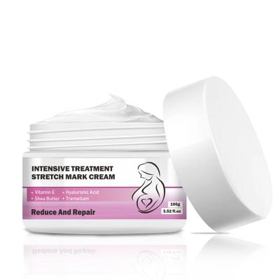 China Best Quality Nourishing Anti Creamanti Stretch Mark Cream China Manufacturer for sale