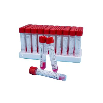 China Lightweight Disposable Viral Type Sampling Tube Saliva Test Medium Kit for sale