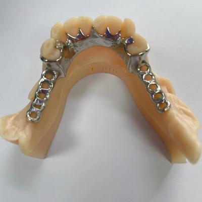 China High Precision Cast Metal Partial Frames Design Removable Partial Dentures for sale