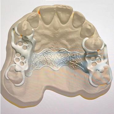 China High Precision Customized Design Service For Titanium Fractional SLM Technology for sale