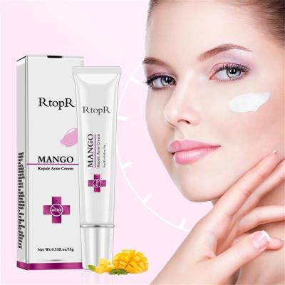 China Professional Skin Revitalizer Acne Treatment 20g Pixie Powder Ointment Remove Scar Cream Acne Treatment Hand Skin Face Care for sale