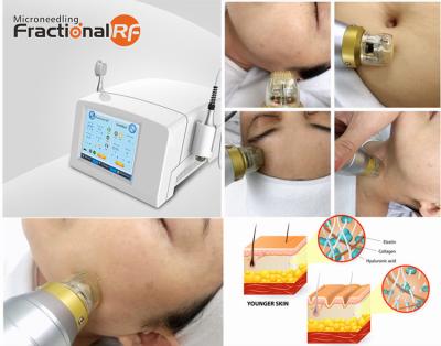 China Portable Fractional Rf Microneedle Machine For Neck Wrinkle Reduction for sale