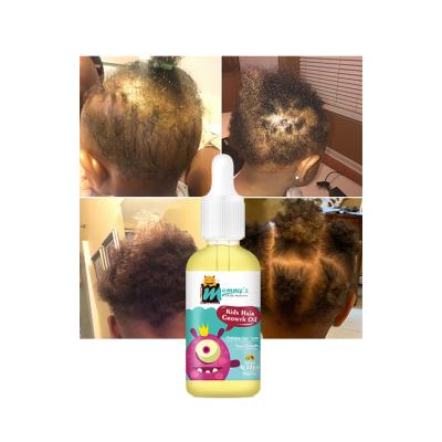 China Loss Prevention Moms Monster Cruelty Free Small No Alcohol Hair Growth Oil For Baby Hair Soft And Moisturize for sale