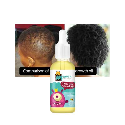 China Baby Hair Care Products Growth Prevention Hair Loss Growth Essence Extra Oil Custom Logo for sale