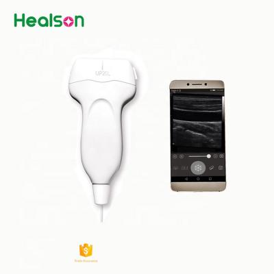 Cina Healson ecografo portatil handheld ultrasound machine for Android UP20 Linear/therapeutic ultrasound in vendita