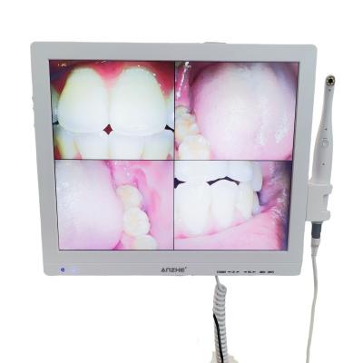 China Wifi All In One Oral Camera With Loudspeaker LCD Screen Dental Oral Camera Scanner for sale