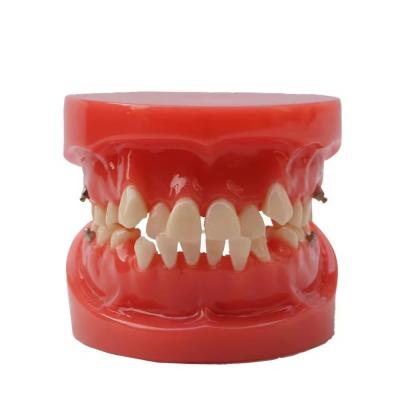 China Training Use Dental Teeth Teaching Model Functional Dental Orthodontic Model Without Bracket for sale