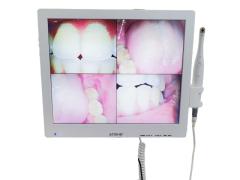 dental oral camera with loudspeaker