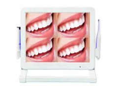 wifi style dental intra oral camera with 1 or 4 screen