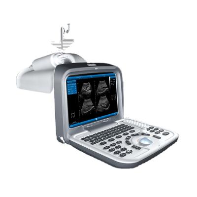 China ZONCARE Metal Hospital Diagnostic Portable 3d Ultrasound PC Base Portable Ultrasound Scanner for sale