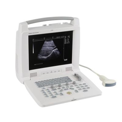 China High Quality Metal Durable Using Various Portable Full Digital Ultrasound Scanner for sale