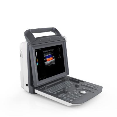 China ZONCARE Metal Hospital Diagnostic Portable 3d Ultrasound PC Base Portable Ultrasound Scanner for sale