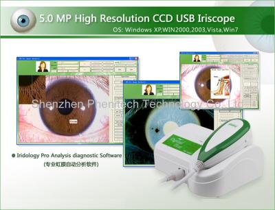 중국 5개의 메가 화소 고해상 Iridology 사진기 USB 연결 판매용