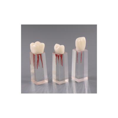 China Fix On Dental Chair Supplies Nissin Educational Type Accessed Root Canal Dental Teeth With Pulp Cavity For Anatomical Type Practice Endodontics Mode for sale