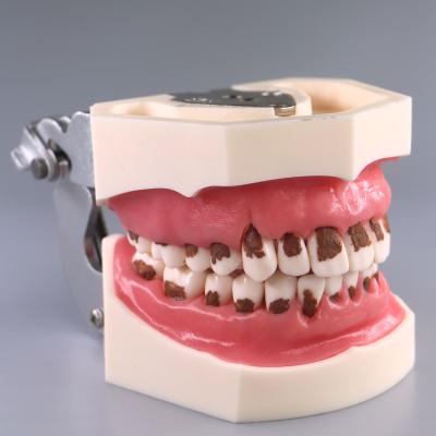 China Dental Resin Root Canal Tooth Model/Dental Study Model Dental Laboratory Equipments for sale