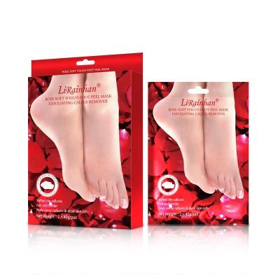 China Peeling Rose Baby Spa Sock Foot Mask Foot Exfoliation Peeling Mask for sale