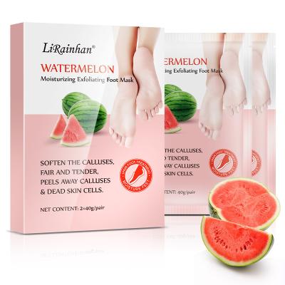 China Remove Corny Layers OEM Watermelon Thick Foot Peeling Mask Cool Foot Spa Dead Skin And Callus Removal Exfoliating Feet Mask for sale